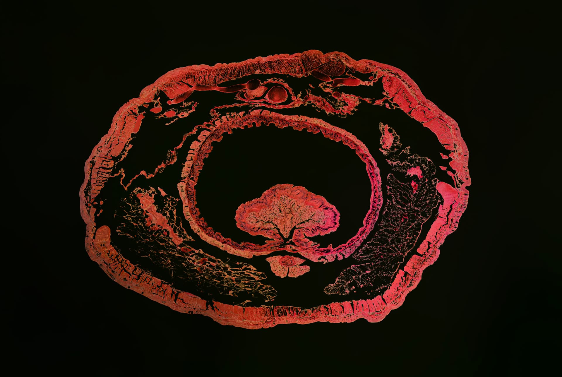 The Life of a Tree, in the Body of an Earthworm