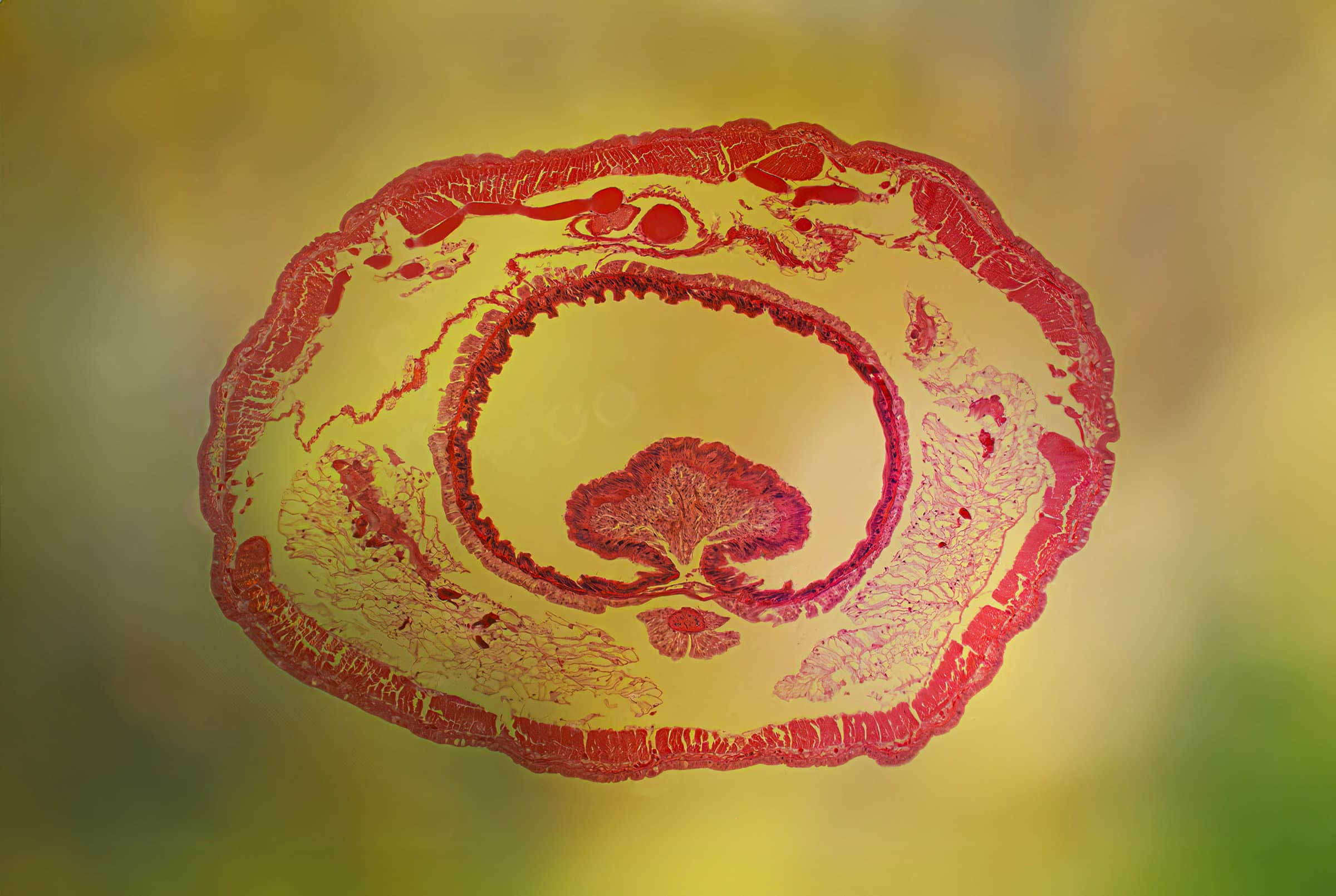 Earthworm Cross Section (20X Magnified)