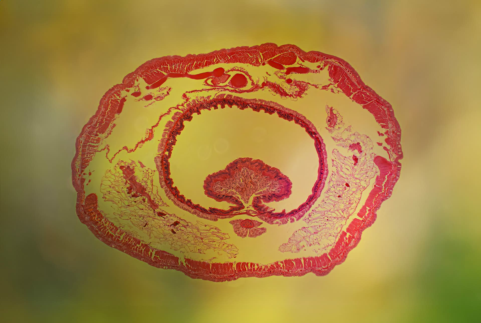 Earthworm Cross Section (20X Magnified)